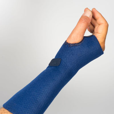 Attelle d’immobilisation de poignet thermoformable – AIPG Cim thermo
